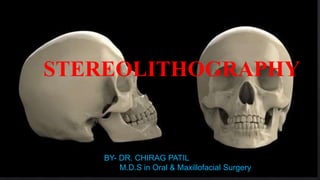STEREOLITHOGRAPHY
BY- DR. CHIRAG PATIL
M.D.S in Oral & Maxillofacial Surgery
 