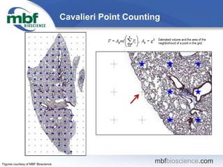mbfbioscience.com
Cavalieri Point Counting
Figures courtesy of MBF Bioscience
 