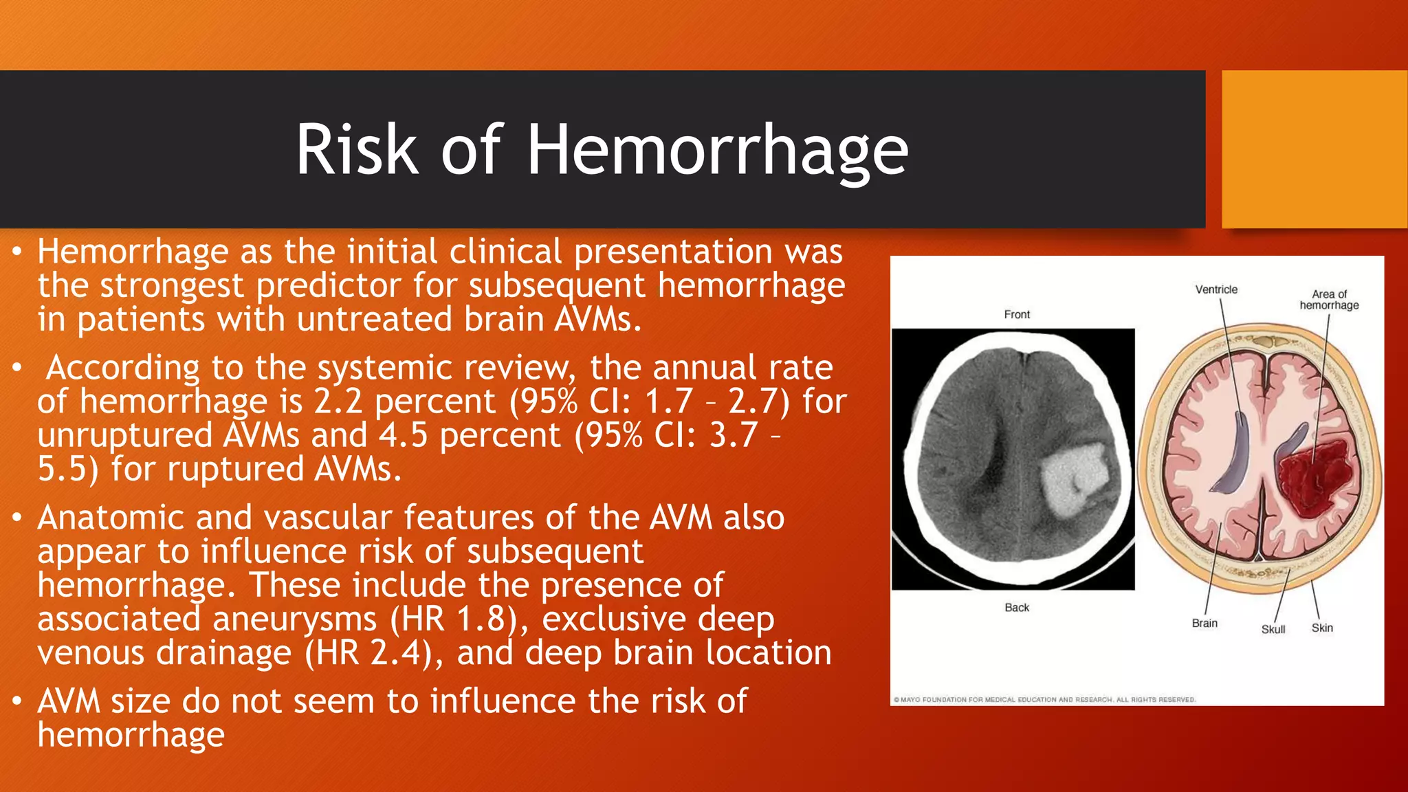 Stereotactic radiosurgery in arterio venous malformations | PPTX