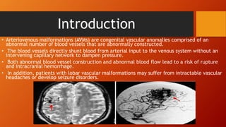 Stereotactic radiosurgery in arterio venous malformations | PPTX