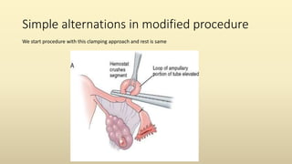 Simple alternations in modified procedure
We start procedure with this clamping approach and rest is same
 