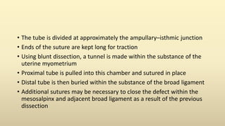 • The tube is divided at approximately the ampullary–isthmic junction
• Ends of the suture are kept long for traction
• Using blunt dissection, a tunnel is made within the substance of the
uterine myometrium
• Proximal tube is pulled into this chamber and sutured in place
• Distal tube is then buried within the substance of the broad ligament
• Additional sutures may be necessary to close the defect within the
mesosalpinx and adjacent broad ligament as a result of the previous
dissection
 