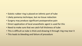 • Sialstic rubber ring is placed on isthmic part of tube
• Likely pomeroy technique, but no tissue reduction
• Surgery may produce significant postoperative pain
• Direct application of local anaesthetic agent is used for this
• Need to make sure that we catch full thickness of tube
• This is difficult as tube is thick and drawing it through ring may tear it
• This leads to bleeding and failure of procedure
 