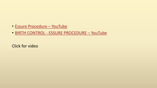 • Essure Procedure – YouTube
• BIRTH CONTROL - ESSURE PROCEDURE – YouTube
Click for video
 