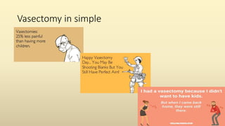 Vasectomy in simple
 
