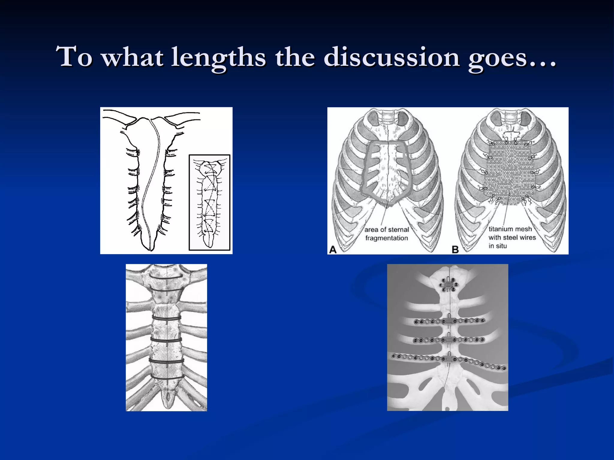 To what lengths the discussion goes… 