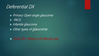 Steroid induced glaucoma