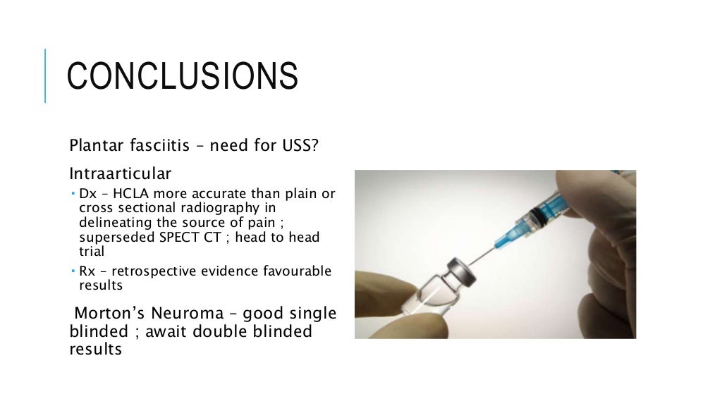 Steroid injections in the foot & ankle