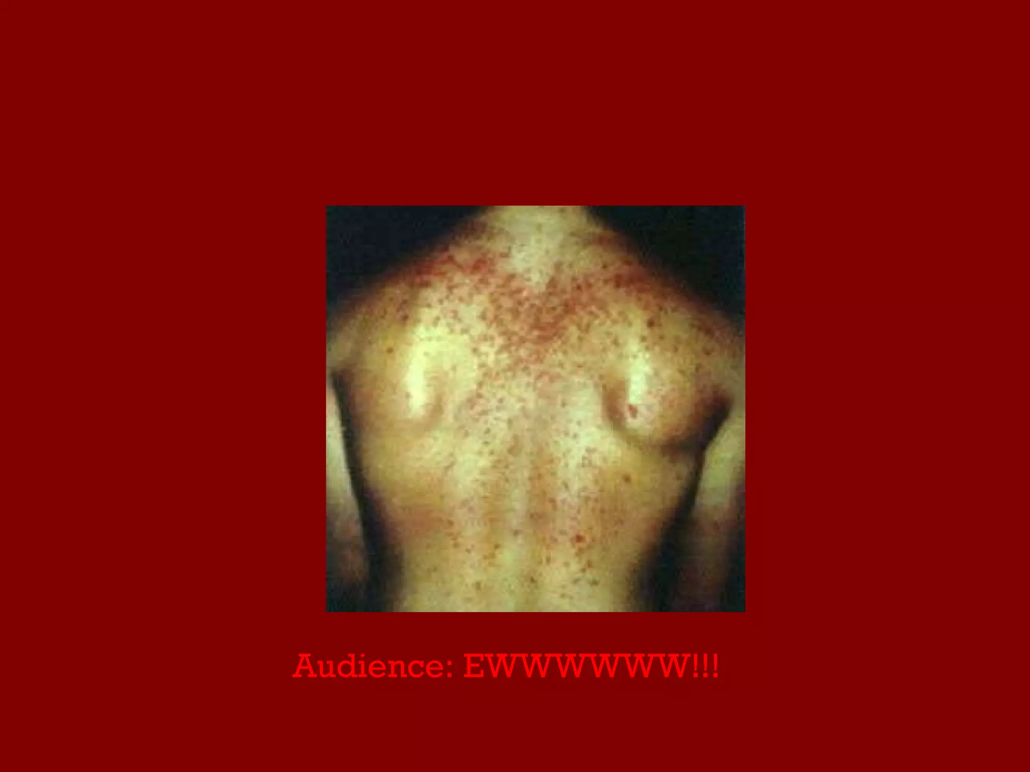 Audience: EWWWWWW!!! 