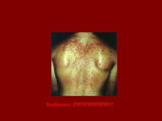 Audience: EWWWWWW!!! 