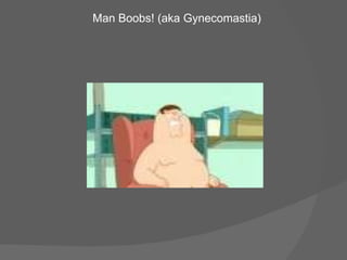 Man Boobs! (aka Gynecomastia) 