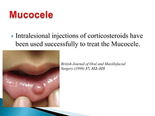  Intralesional injections of corticosteroids have
been used successfully to treat the Mucocele.
British Journal of Oral and Maxillofacial
Surgery (1999) 37, 312–315
 