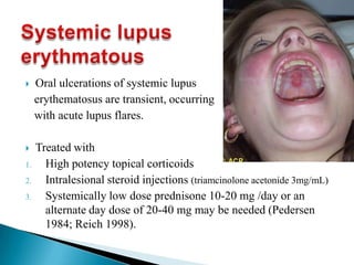  Oral ulcerations of systemic lupus
erythematosus are transient, occurring
with acute lupus flares.
 Treated with
1. High potency topical corticoids
2. Intralesional steroid injections (triamcinolone acetonide 3mg/mL)
3. Systemically low dose prednisone 10-20 mg /day or an
alternate day dose of 20-40 mg may be needed (Pedersen
1984; Reich 1998).
 