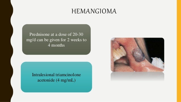 Steroids in dentistry