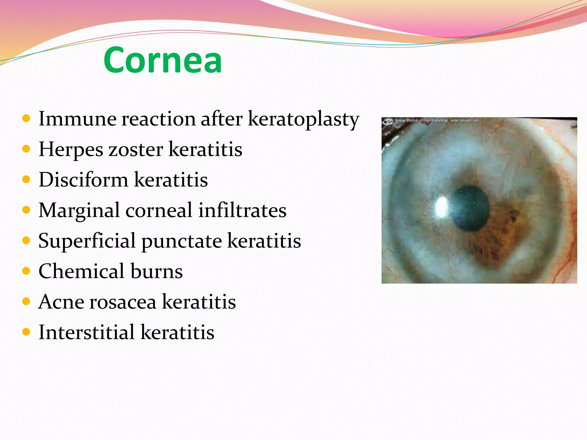 Cornea
 Immune reaction after keratoplasty
 Herpes zoster keratitis
 Disciform keratitis
 Marginal corneal infiltrates
 Superficial punctate keratitis
 Chemical burns
 Acne rosacea keratitis
 Interstitial keratitis
 