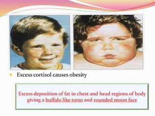 3.Effect on fat metabolism
 Mobilization of fatty acids
 Excess cortisol causes obesity
It promotes mobilization of free fatty acids from adipose
tissue
Increases the concentration of free fatty acids in plasma ,
which increases there utilization for energy
Excess deposition of fat in chest and head regions of body
giving a buffalo like torso and rounded moon face
 