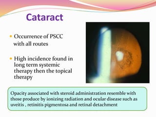 Cataract
 Occurrence of PSCC
with all routes
 High incidence found in
long term systemic
therapy then the topical
therapy
Opacity associated with steroid administration resemble with
those produce by ionizing radiation and ocular disease such as
uveitis , retinitis pigmentosa and retinal detachment
 