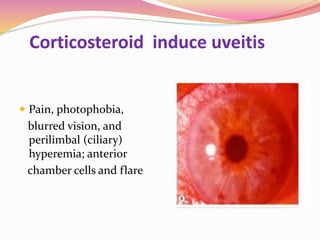 Corticosteroid induce uveitis
 Pain, photophobia,
blurred vision, and
perilimbal (ciliary)
hyperemia; anterior
chamber cells and flare
 