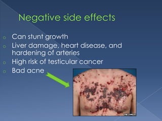 Can stunt growth
o Liver damage, heart disease, and
hardening of arteries
o High risk of testicular cancer
o Bad acne
o

 