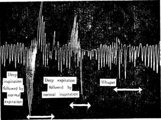 Stethograph- Recording Respiratory Movements