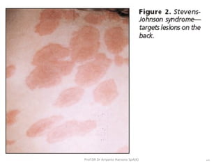 14Prof DR Dr Ariyanto Harsono SpA(K)
 