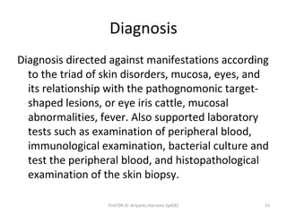 Diagnosis
Diagnosis directed against manifestations according
to the triad of skin disorders, mucosa, eyes, and
its relationship with the pathognomonic target-
shaped lesions, or eye iris cattle, mucosal
abnormalities, fever. Also supported laboratory
tests such as examination of peripheral blood,
immunological examination, bacterial culture and
test the peripheral blood, and histopathological
examination of the skin biopsy.
15Prof DR Dr Ariyanto Harsono SpA(K)
 