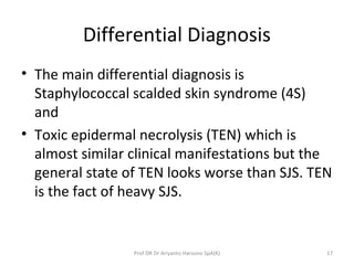 Differential Diagnosis
• The main differential diagnosis is
Staphylococcal scalded skin syndrome (4S)
and
• Toxic epidermal necrolysis (TEN) which is
almost similar clinical manifestations but the
general state of TEN looks worse than SJS. TEN
is the fact of heavy SJS.
17Prof DR Dr Ariyanto Harsono SpA(K)
 