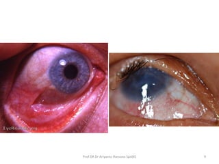 Prof DR Dr Ariyanto Harsono SpA(K) 9
 