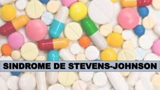 SINDROME DE STEVENS-JOHNSON
 