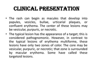 Clinical Presentation
• The rash can begin as macules that develop into
papules, vesicles, bullae, urticarial plaques, or
confluent erythema. The center of these lesions may
be vesicular, purpuric, or necrotic.
• The typical lesion has the appearance of a target; this is
considered pathognomonic. However, in contrast to
the typical lesions of erythema multiforme, these
lesions have only two zones of color. The core may be
vesicular, purpuric, or necrotic; that zone is surrounded
by macular erythema. Some have called these
targetoid lesions.
 