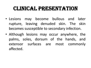 Clinical Presentation
• Lesions may become bullous and later
rupture, leaving denuded skin. The skin
becomes susceptible to secondary infection.
• Although lesions may occur anywhere, the
palms, soles, dorsum of the hands, and
extensor surfaces are most commonly
affected.
 