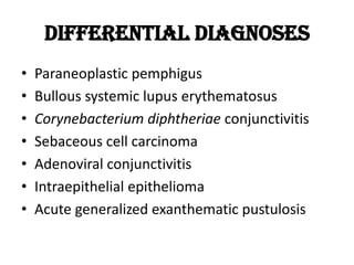 Differential Diagnoses
• Paraneoplastic pemphigus
• Bullous systemic lupus erythematosus
• Corynebacterium diphtheriae conjunctivitis
• Sebaceous cell carcinoma
• Adenoviral conjunctivitis
• Intraepithelial epithelioma
• Acute generalized exanthematic pustulosis
 
