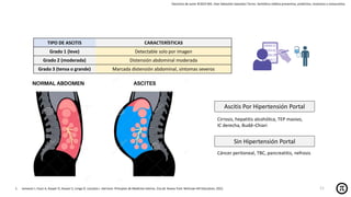 Derechos de autor ©2025 MD. Jhan Sebastián Saavedra Torres- Semiótica médica preventiva, predictiva, resolutiva y restaurativa.
1. Jameson J, Fauci A, Kasper D, Hauser S, Longo D, Loscalzo J. Harrison. Principios de Medicina Interna. 21a ed. Nueva York: McGraw-Hill Education; 2022.
Ascitis Por Hipertensión Portal
Sin Hipertensión Portal
Cirrosis, hepatitis alcohólica, TEP masivo,
IC derecha, Budd–Chiari
Cáncer peritoneal, TBC, pancreatitis, nefrosis
TIPO DE ASCITIS CARACTERÍSTICAS
Grado 1 (leve) Detectable solo por imagen
Grado 2 (moderada) Distensión abdominal moderada
Grado 3 (tensa o grande) Marcada distensión abdominal, síntomas severos
11
 