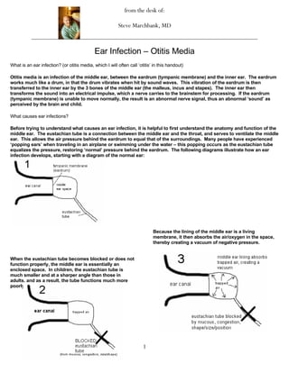 from the desk of:

                                                          Steve Marchbank, MD



                                             Ear Infection – Otitis Media
What is an ear infection? (or otitis media, which I will often call ‘otitis’ in this handout)

Otitis media is an infection of the middle ear, between the eardrum (tympanic membrane) and the inner ear. The eardrum
works much like a drum, in that the drum vibrates when hit by sound waves. This vibration of the eardrum is then
transferred to the inner ear by the 3 bones of the middle ear (the malleus, incus and stapes). The inner ear then
transforms the sound into an electrical impulse, which a nerve carries to the brainstem for processing. If the eardrum
(tympanic membrane) is unable to move normally, the result is an abnormal nerve signal, thus an abnormal ‘sound’ as
perceived by the brain and child.

What causes ear infections?

Before trying to understand what causes an ear infection, it is helpful to first understand the anatomy and function of the
middle ear. The eustachian tube is a connection between the middle ear and the throat, and serves to ventilate the middle
ear. This allows the air pressure behind the eardrum to equal that of the surroundings. Many people have experienced
‘popping ears’ when traveling in an airplane or swimming under the water – this popping occurs as the eustachian tube
equalizes the pressure, restoring ‘normal’ pressure behind the eardrum. The following diagrams illustrate how an ear
infection develops, starting with a diagram of the normal ear:




                                                                            Because the lining of the middle ear is a living
                                                                            membrane, it then absorbs the air/oxygen in the space,
                                                                            thereby creating a vacuum of negative pressure.


When the eustachian tube becomes blocked or does not
function properly, the middle ear is essentially an
enclosed space. In children, the eustachian tube is
much smaller and at a sharper angle than those in
adults, and as a result, the tube functions much more
poorly.




                                                                       1
 