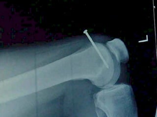 Ups, Downs and Sideways
•  If you automate a mess you end up with a….
•  If what you are doing is dumb making that more efficient
is dumber
 