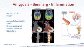 Amygdala - Benmärg - Inflammation
Tawakol Lancet 2017
N= 293, 3-7 år
PET/CT
Amygdala kopplas till:
Stress
Benmärgsaktivite...