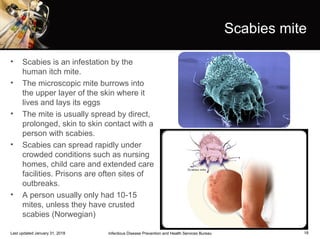 18
Scabies mite
• Scabies is an infestation by the
human itch mite.
• The microscopic mite burrows into
the upper layer of the skin where it
lives and lays its eggs
• The mite is usually spread by direct,
prolonged, skin to skin contact with a
person with scabies.
• Scabies can spread rapidly under
crowded conditions such as nursing
homes, child care and extended care
facilities. Prisons are often sites of
outbreaks.
• A person usually only had 10-15
mites, unless they have crusted
scabies (Norwegian)
Infectious Disease Prevention and Health Services BureauLast updated January 31, 2018
 