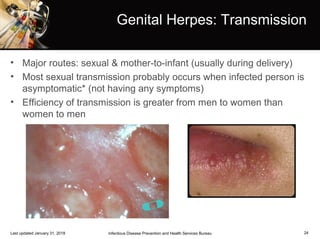 Genital Herpes: Transmission
• Major routes: sexual & mother-to-infant (usually during delivery)
• Most sexual transmission probably occurs when infected person is
asymptomatic* (not having any symptoms)
• Efficiency of transmission is greater from men to women than
women to men
24Infectious Disease Prevention and Health Services BureauLast updated January 31, 2018
 
