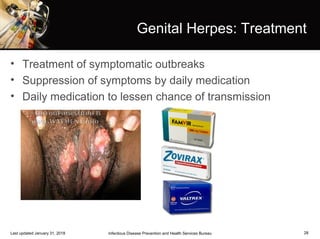 28
Genital Herpes: Treatment
• Treatment of symptomatic outbreaks
• Suppression of symptoms by daily medication
• Daily medication to lessen chance of transmission
Infectious Disease Prevention and Health Services BureauLast updated January 31, 2018
 
