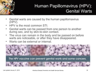 30
Human Papillomavirus (HPV):
Genital Warts
• Genital warts are caused by the human papillomavirus
(HPV).
• HPV is the most common STI.
• Genital warts can be passed from one person to another
during sex, and by skin-to-skin contact.
• The virus can remain in the body and be passed on before
warts are noticeable, or after they have disappeared.
• Warts can be external or internal.
Infectious Disease Prevention and Health Services BureauLast updated January 31, 2018
 