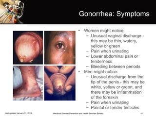 41
Gonorrhea: Symptoms
• Women might notice:
– Unusual vaginal discharge -
this may be thin, watery,
yellow or green
– Pain when urinating
– Lower abdominal pain or
tenderness
– Bleeding between periods
• Men might notice:
– Unusual discharge from the
tip of the penis - this may be
white, yellow or green, and
there may be inflammation
of the foreskin
– Pain when urinating
– Painful or tender testicles
Infectious Disease Prevention and Health Services BureauLast updated January 31, 2018
 