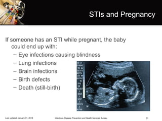 71
STIs and Pregnancy
If someone has an STI while pregnant, the baby
could end up with:
– Eye infections causing blindness
– Lung infections
– Brain infections
– Birth defects
– Death (still-birth)
Infectious Disease Prevention and Health Services BureauLast updated January 31, 2018
 