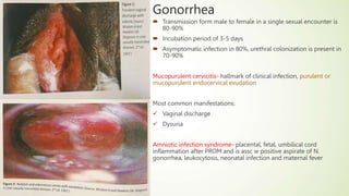  Transmission form male to female in a single sexual encounter is
80-90%
 Incubation period of 3-5 days
 Asymptomatic infection in 80%, urethral colonization is present in
70-90%
Mucopurulent cervicitis- hallmark of clinical infection, purulent or
mucopurulent endocervical exudation
Most common manifestations:
 Vaginal discharge
 Dysuria
Amniotic infection syndrome- placental, fetal, umbilical cord
inflammation after PROM and is assc w positive aspirate of N.
gonorrhea, leukocytosis, neonatal infection and maternal fever
Gonorrhea
 
