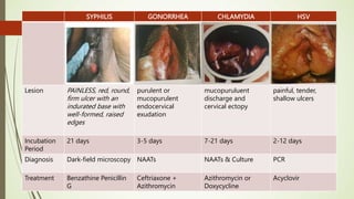 SYPHILIS GONORRHEA CHLAMYDIA HSV
Lesion PAINLESS, red, round,
firm ulcer with an
indurated base with
well-formed, raised
edges
purulent or
mucopurulent
endocervical
exudation
mucopuruluent
discharge and
cervical ectopy
painful, tender,
shallow ulcers
Incubation
Period
21 days 3-5 days 7-21 days 2-12 days
Diagnosis Dark-field microscopy NAATs NAATs & Culture PCR
Treatment Benzathine Penicillin
G
Ceftriaxone +
Azithromycin
Azithromycin or
Doxycycline
Acyclovir
 