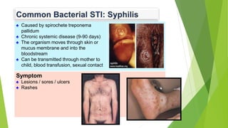 Treponema Rash STI and HIV Education - longer.pptx