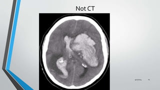 Not CT 
9/27/2014 14 
 