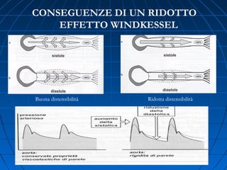 CONSEGUENZE DI UN RIDOTTO
EFFETTO WINDKESSEL
Buona distensibilità Ridotta distensibilità
 
