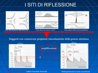 I SITI DI RIFLESSIONE
Onde riflesse generate dalle biforcazioni Onde riflesse da stenosi e tombi Onde rifllesse dalle resistenze periferiche
Onda pressoria periferica radiale brachiale femorale Onda pressoria in aorta ascendente
prima dopo
Soggetti con conservate proprietà viscoelastiche della parete arteriosa
amplificazione
 