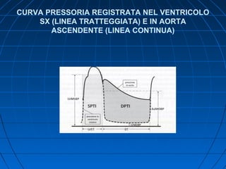 CURVA PRESSORIA REGISTRATA NEL VENTRICOLO
SX (LINEA TRATTEGGIATA) E IN AORTA
ASCENDENTE (LINEA CONTINUA)
 