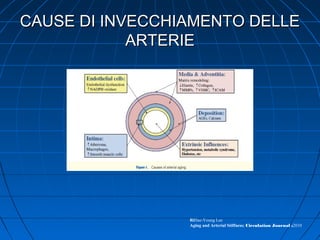 CAUSE DI INVECCHIAMENTO DELLECAUSE DI INVECCHIAMENTO DELLE
ARTERIEARTERIE
RiHae-Young Lee
Aging and Arterial Stiffness; Circulation Journal ;2010
 